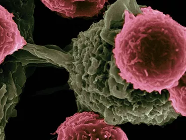 Les cancers en 2026 : entre craintes et espoirs